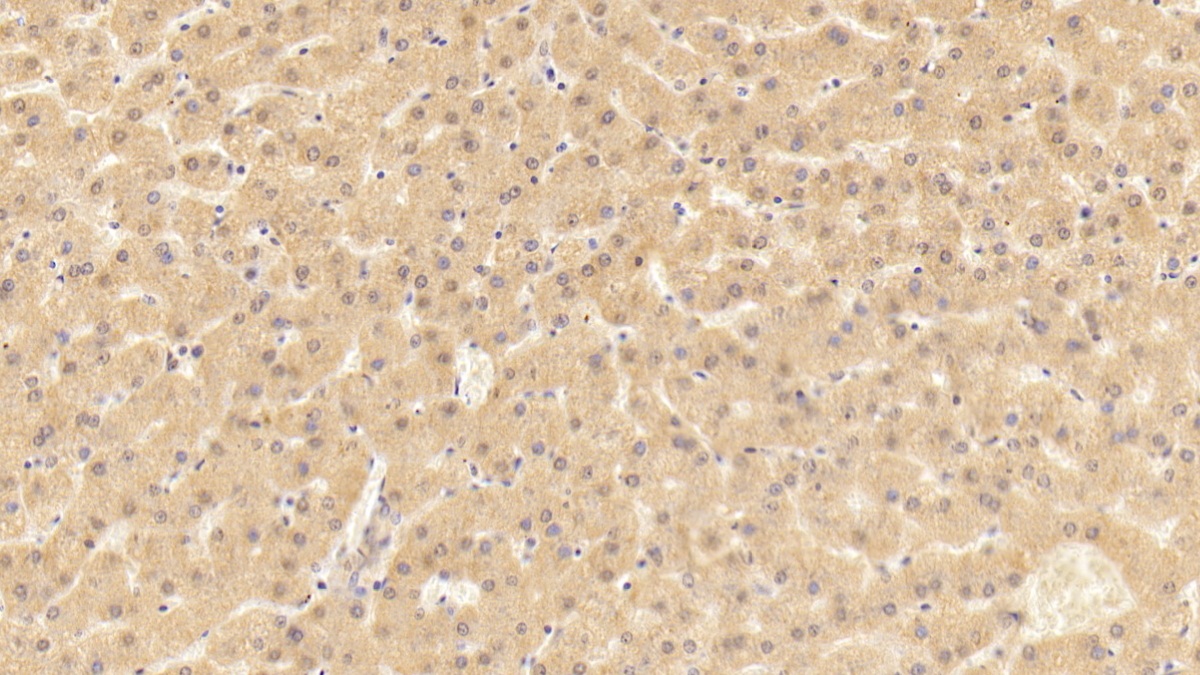 Polyclonal Antibody to Neutrophil Cytosolic Factor 4 (NCF4)