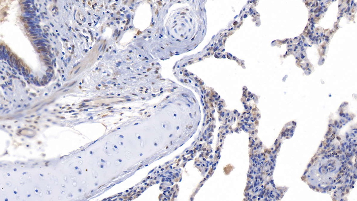 Polyclonal Antibody to Asprosin (Asp)