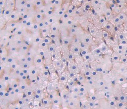 Polyclonal Antibody to ATP Binding Cassette Transporter D1 (ABCD1)