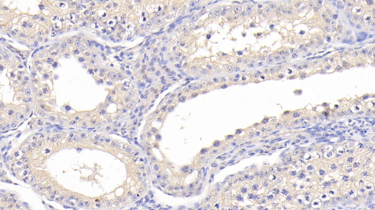 Polyclonal Antibody to Cathepsin A (CTSA)