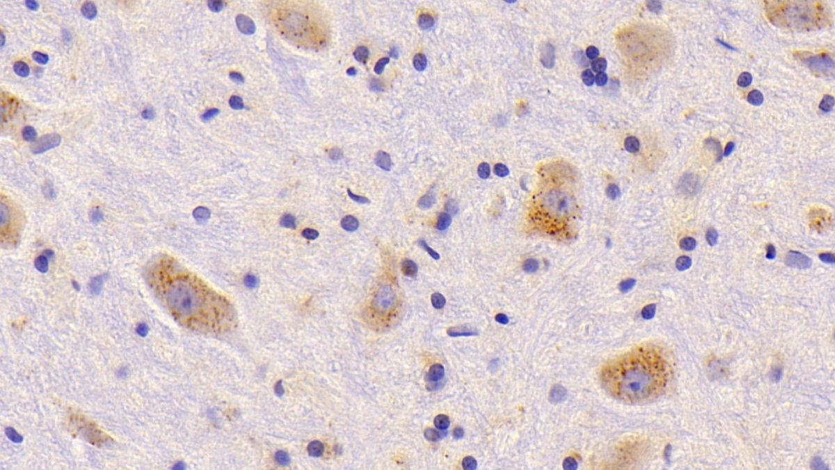 Polyclonal Antibody to Cathepsin A (CTSA)