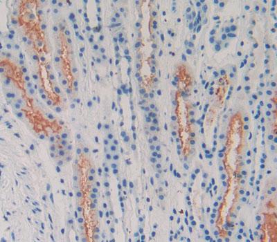 Polyclonal Antibody to Latrophilin 2 (LPHN2)