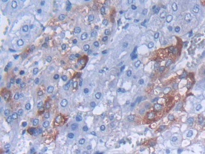 Polyclonal Antibody to Cocaine And Amphetamine Regulated Transcript (CART)