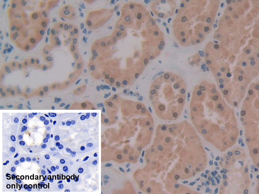 Polyclonal Antibody to Protein Kinase Inhibitor Beta (PKIb)