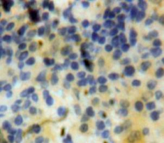 Polyclonal Antibody to Interferon Gamma Induced Protein 10kDa (IP10)