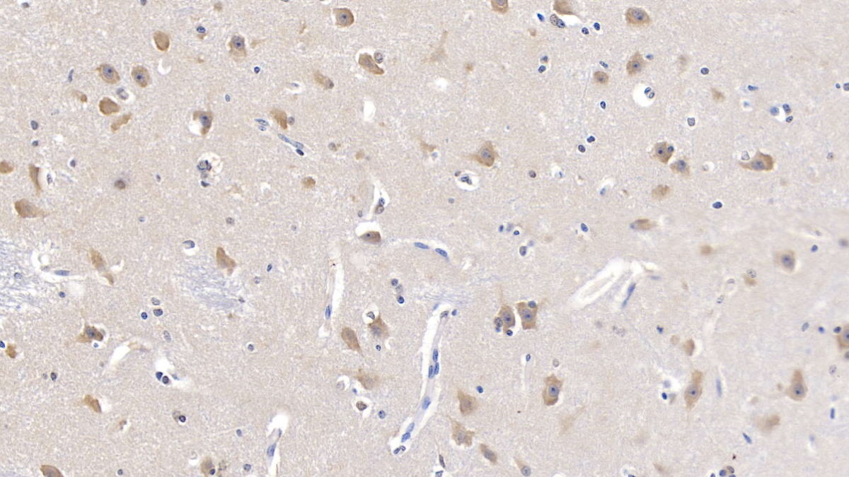 Polyclonal Antibody to Gelsolin (GSN)