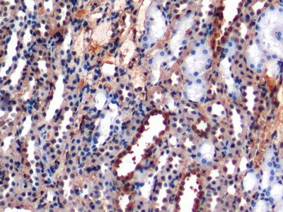 Polyclonal Antibody to Gelsolin (GSN)