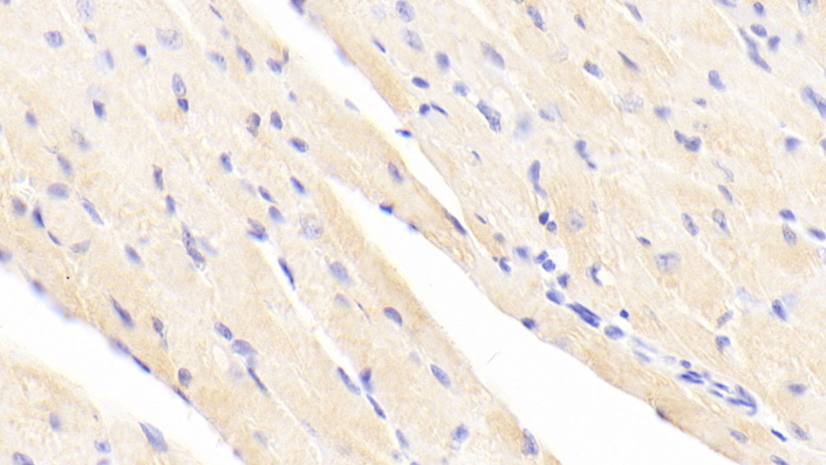 Polyclonal Antibody to Actinin Alpha 2 (ACTN2)