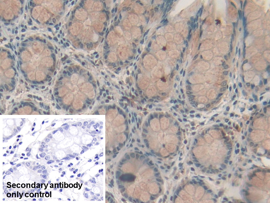 Polyclonal Antibody to Retinol Binding Protein 2, Cellular (RBP2)