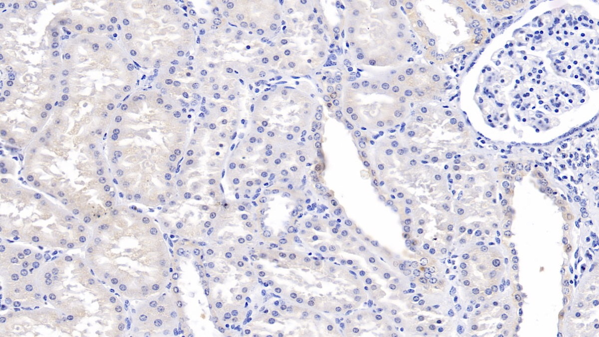 Polyclonal Antibody to Tissue Factor Pathway Inhibitor (TFPI)