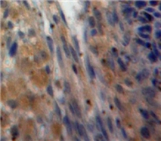 Polyclonal Antibody to Inhibin Alpha (INHa)