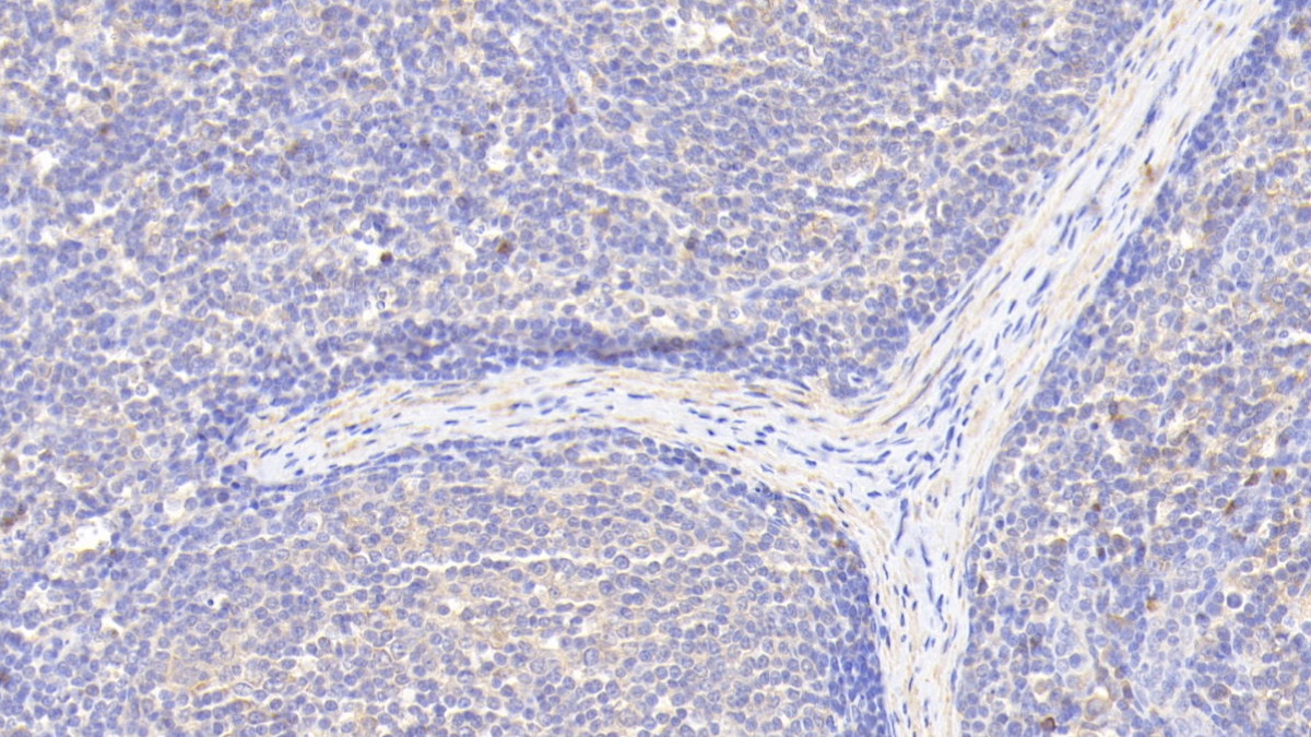 Polyclonal Antibody to Inhibin Alpha (INHa)