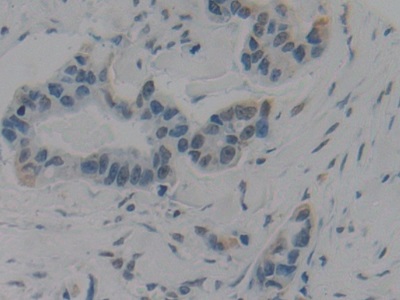 Polyclonal Antibody to High Mobility Group Protein 1 (HMGB1)