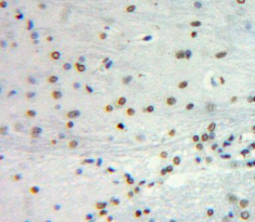 Polyclonal Antibody to Sex Determining Region Y Box Protein 2 (SOX2)