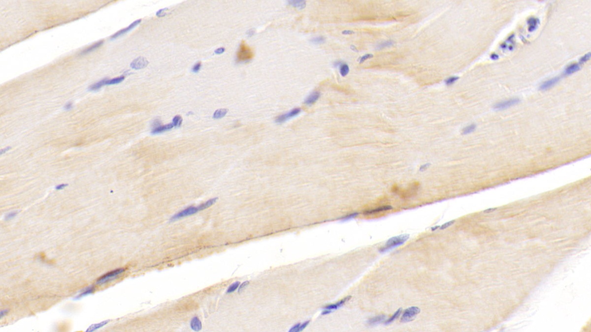 Polyclonal Antibody to Phospholipase A2, Calcium Independent (iPLA2)