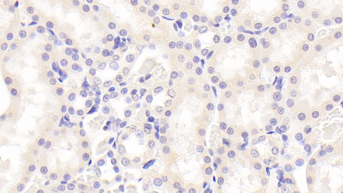 Polyclonal Antibody to Sex Determining Region Y Box Protein 18 (SOX18)