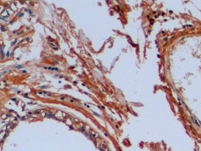 Polyclonal Antibody to Octamer Binding Transcription Factor 4 (OCT4)