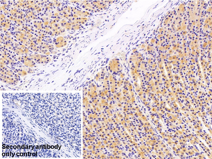 Polyclonal Antibody to Apobec 1 Complementation Factor (ACF)