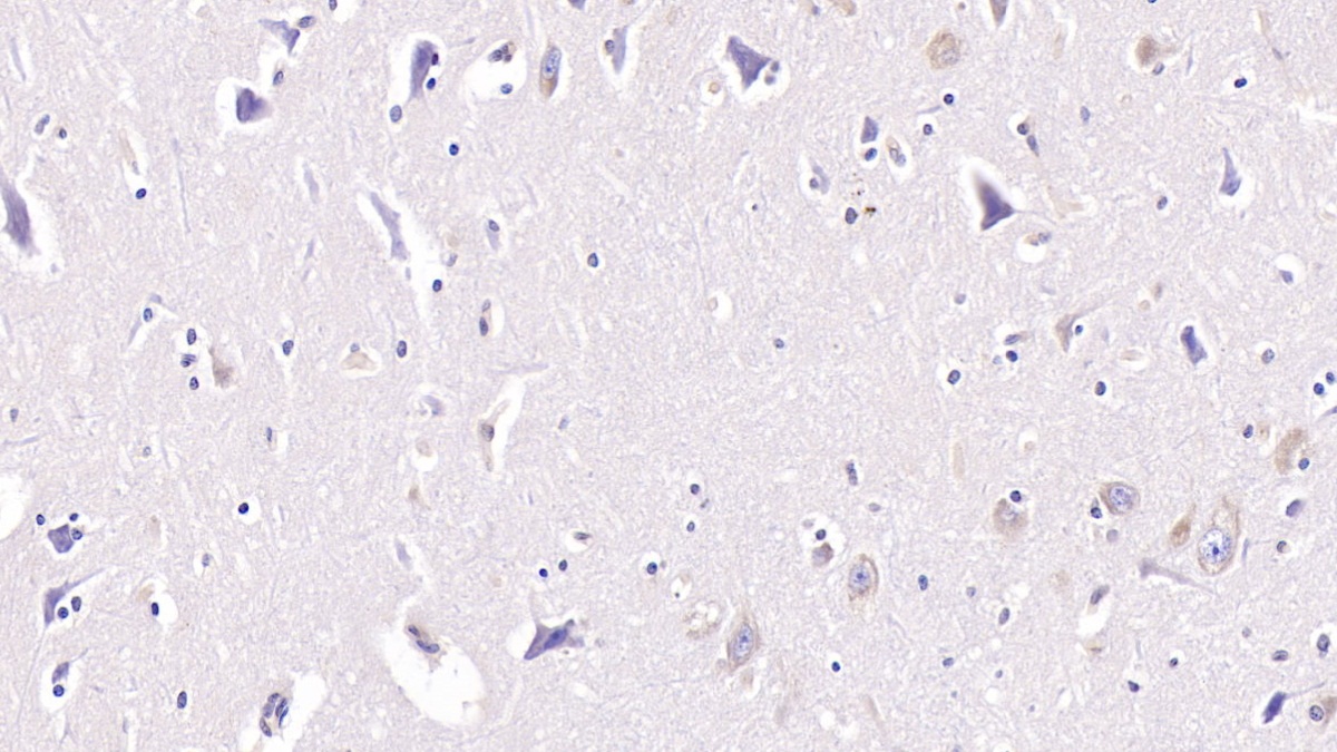 Polyclonal Antibody to Neurokinin A (NKA)