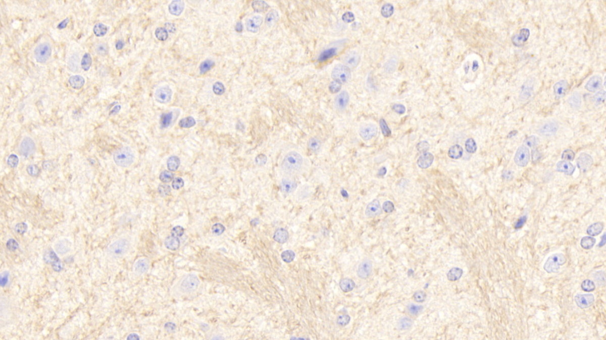 Polyclonal Antibody to Sirtuin 2 (SIRT2)