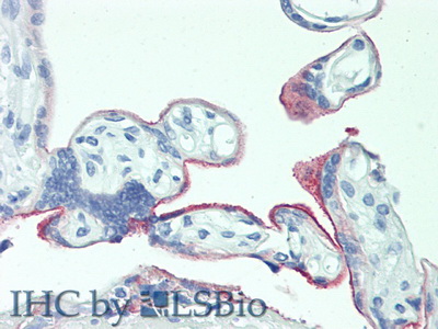 Polyclonal Antibody to 5T4