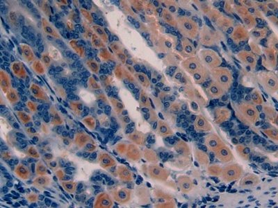 Polyclonal Antibody to Growth Hormone Releasing Hormone (GHRH)