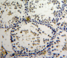 Polyclonal Antibody to Apoptosis Antagonizing Transcription Factor (AATF)