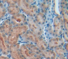 Polyclonal Antibody to Apoptosis Antagonizing Transcription Factor (AATF)