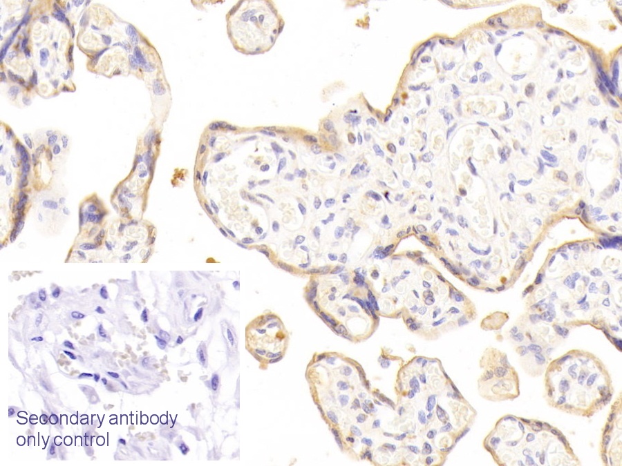 Polyclonal Antibody to Desmoglein 3 (DSG3)