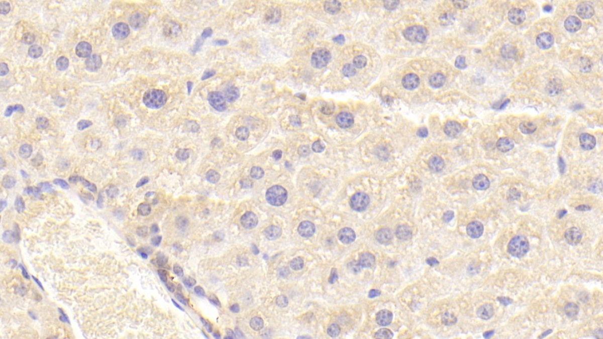 Polyclonal Antibody to Inhibin Beta C (INHbC)