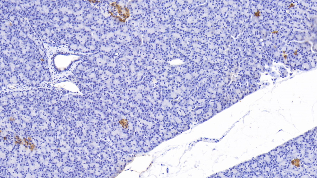 Polyclonal Antibody to C-Peptide (CP)