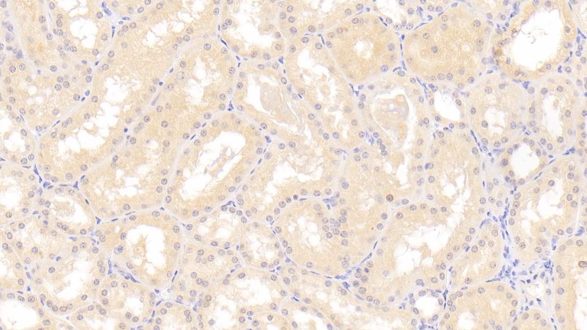 Polyclonal Antibody to Mineralocorticoid Receptor (MR)