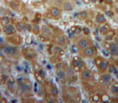 Polyclonal Antibody to Lipase, Endothelial (LIPG)