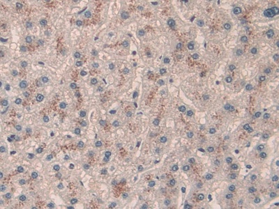 Polyclonal Antibody to Calcitonin (CT)