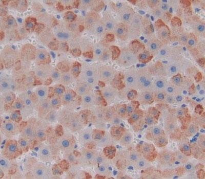 Polyclonal Antibody to Calcitonin (CT)