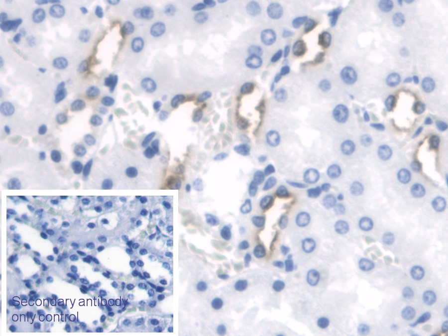 Polyclonal Antibody to Parathyroid Hormone Receptor 2 (PTHR2)