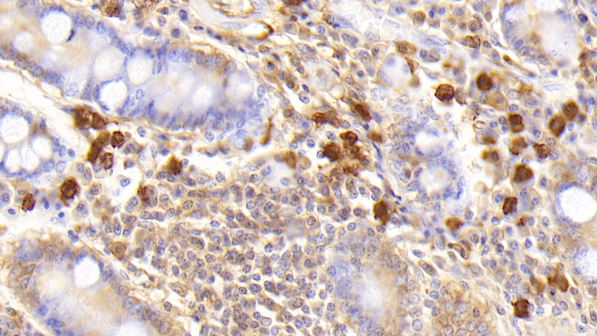 Polyclonal Antibody to Cystatin A (CSTA)