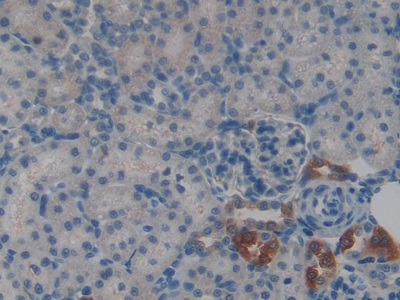 Polyclonal Antibody to Cystatin A (CSTA)