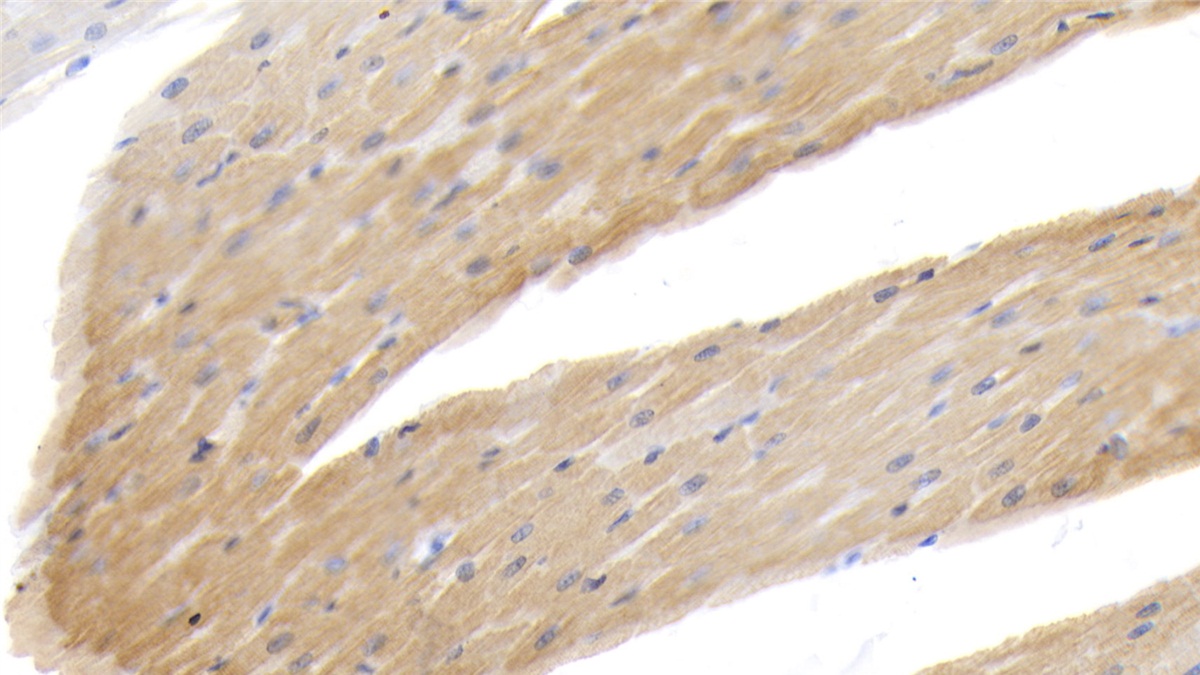 Polyclonal Antibody to Cardiac Troponin I (cTnI)