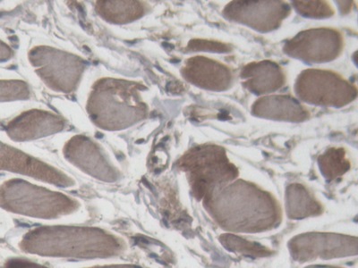 Polyclonal Antibody to Cardiac Troponin I (cTnI)