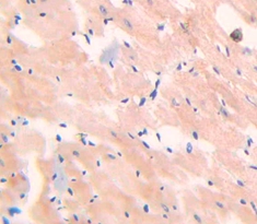 Polyclonal Antibody to Myoglobin (MYO)