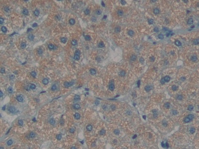 Polyclonal Antibody to Endothelin 1 (EDN1)