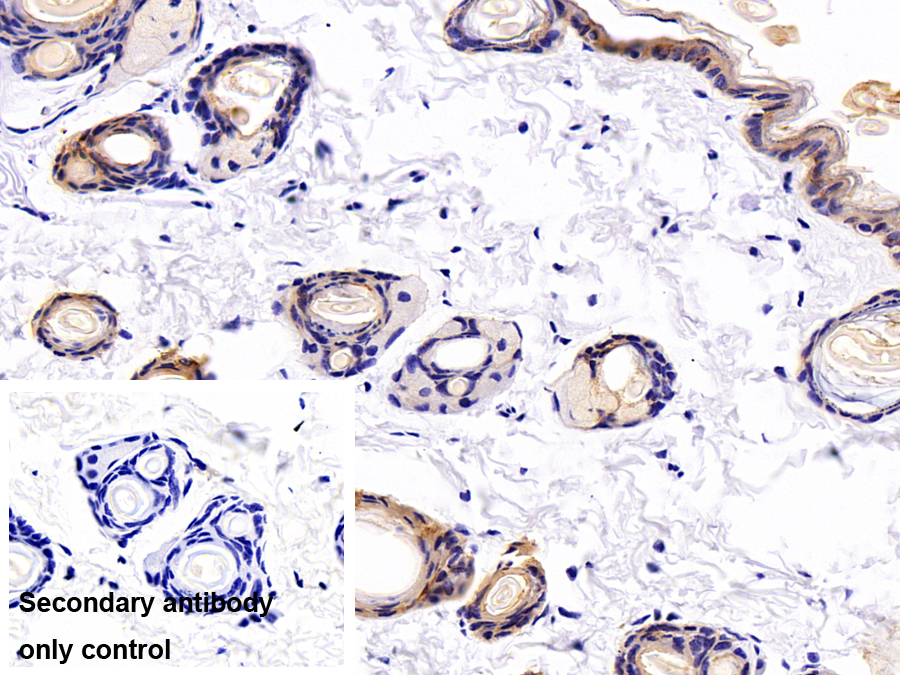 Polyclonal Antibody to Cytokeratin 5 (CK5)