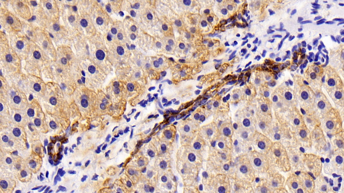 Polyclonal Antibody to Cytokeratin 4 (CK4)