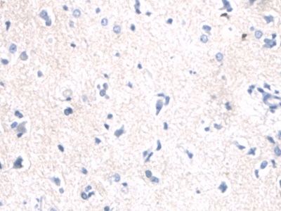 Polyclonal Antibody to Keratin 2 (CK2)