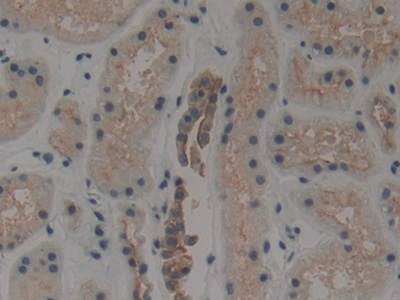 Polyclonal Antibody to Cytokeratin 1 (CK1)