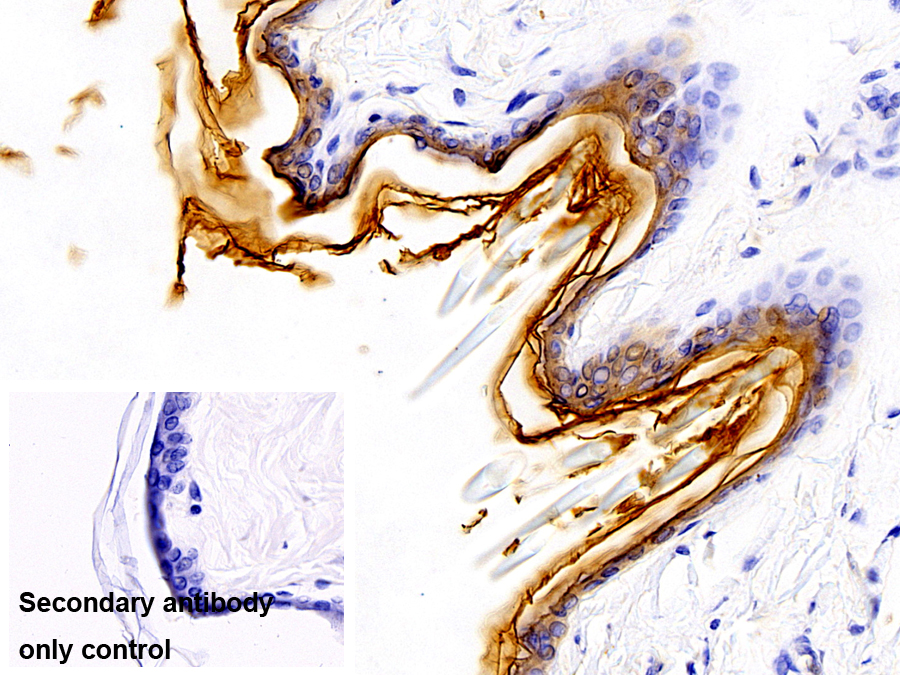 Polyclonal Antibody to Cytokeratin 1 (CK1)