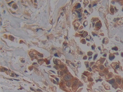 Polyclonal Antibody to Protein Kinase C Iota (PKCi)