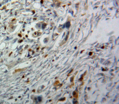 Polyclonal Antibody to Cyclin Dependent Kinase 9 (CDK9)