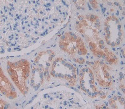 Polyclonal Antibody to Nestin (NES)